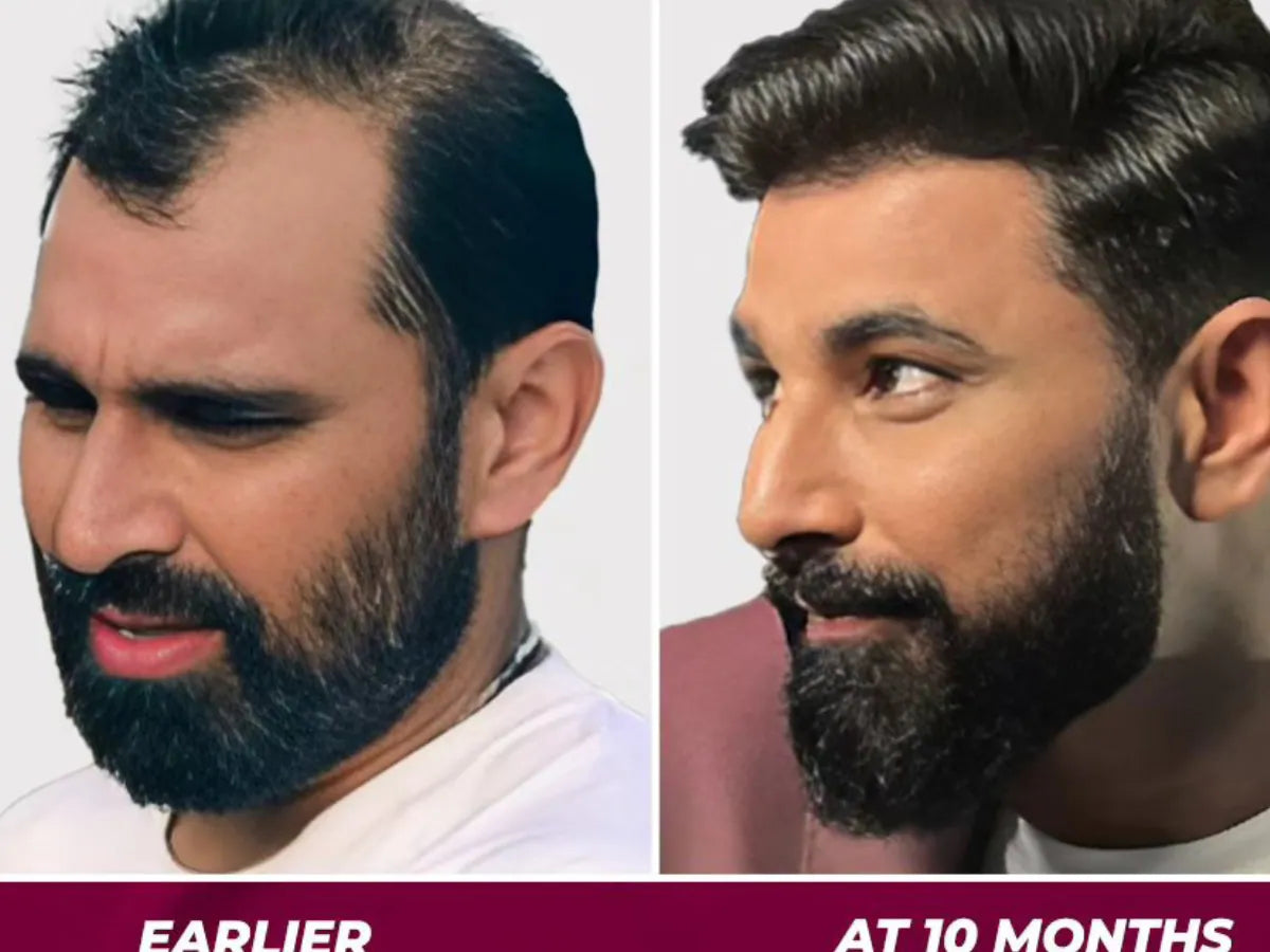 Jamalgota™ Ayurvedic Hair Growth Powder